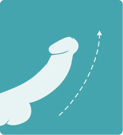 Medical-style illustration showing the second stage of increased penile blood flow in the Soda Peak explanation